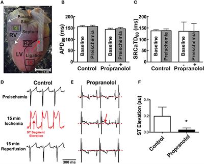 β-Adrenergic Inhibition Prevents Action Potential and Calcium Handling Changes during Regional Myocardial Ischemia